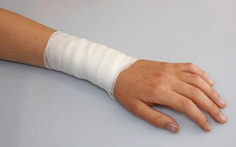 Enfermeira usa curativo para tratar queimadura no braço