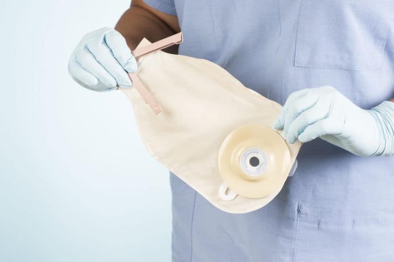 Enfermeira segurando bolsa de colostomia