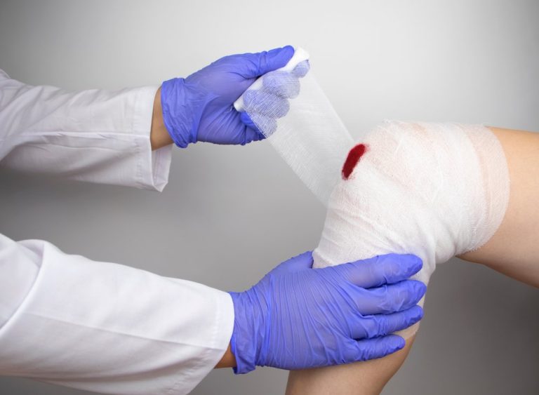 Médico fazendo curativo em ferida aberta no joelho do paciente