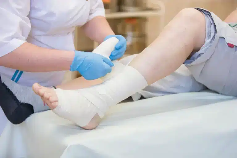 Enfermeira auxilia no tratamento de ferida de pé diabético com necrose