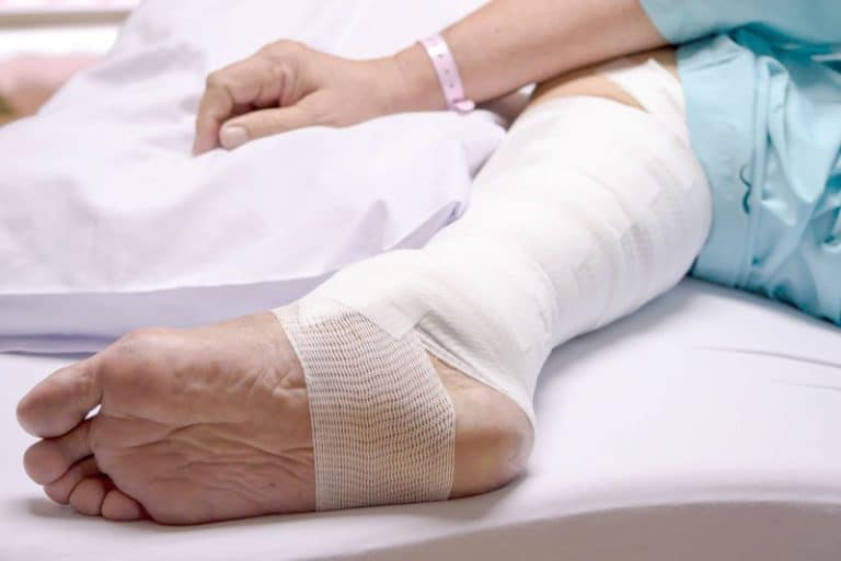 enfermeira faz curativo em ferida cirúrgica na perna