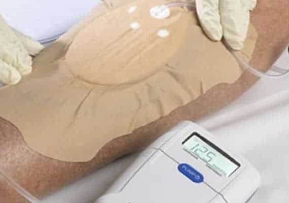 imagem mostra aparelho de curativo a vácuo sendo aplicado na perna de um paciente